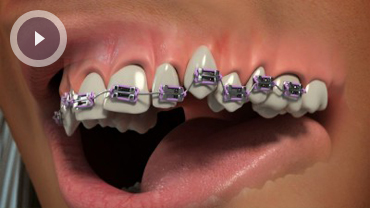 Orthodontics